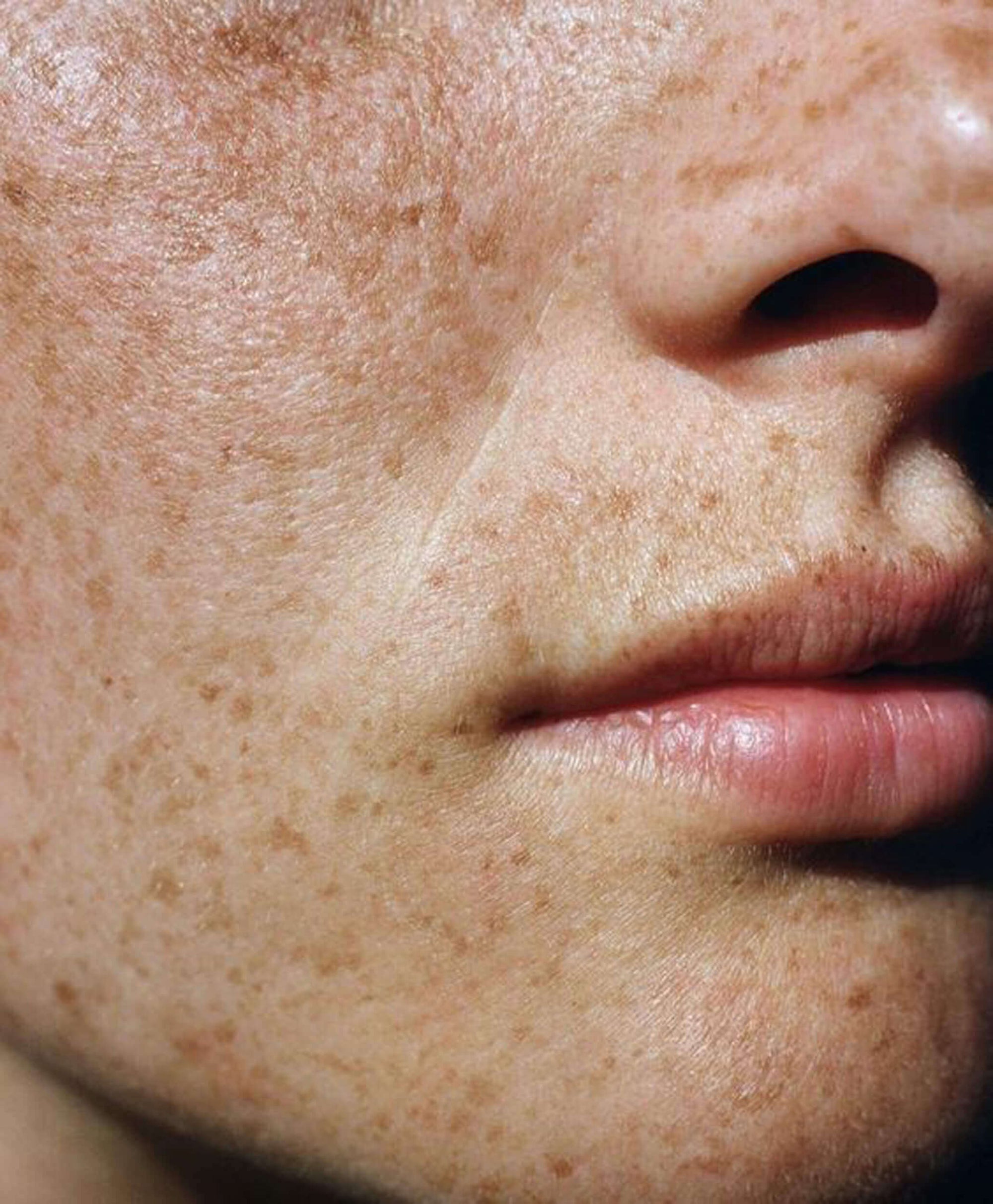 Acne treatment products at Klinika