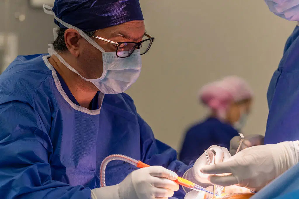 Arm Liposuction