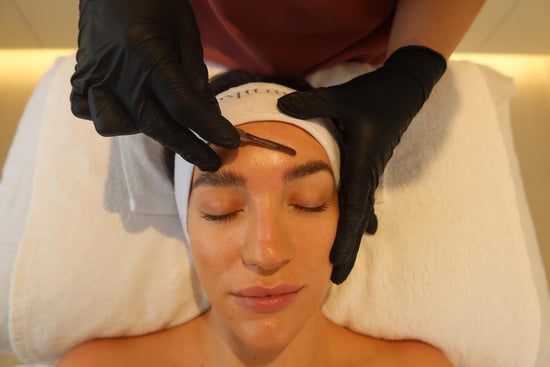 Peach Fuzz Facial